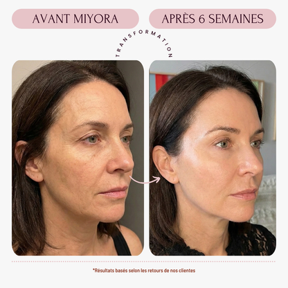 Miyora 24K Micro-Infusion Ritual