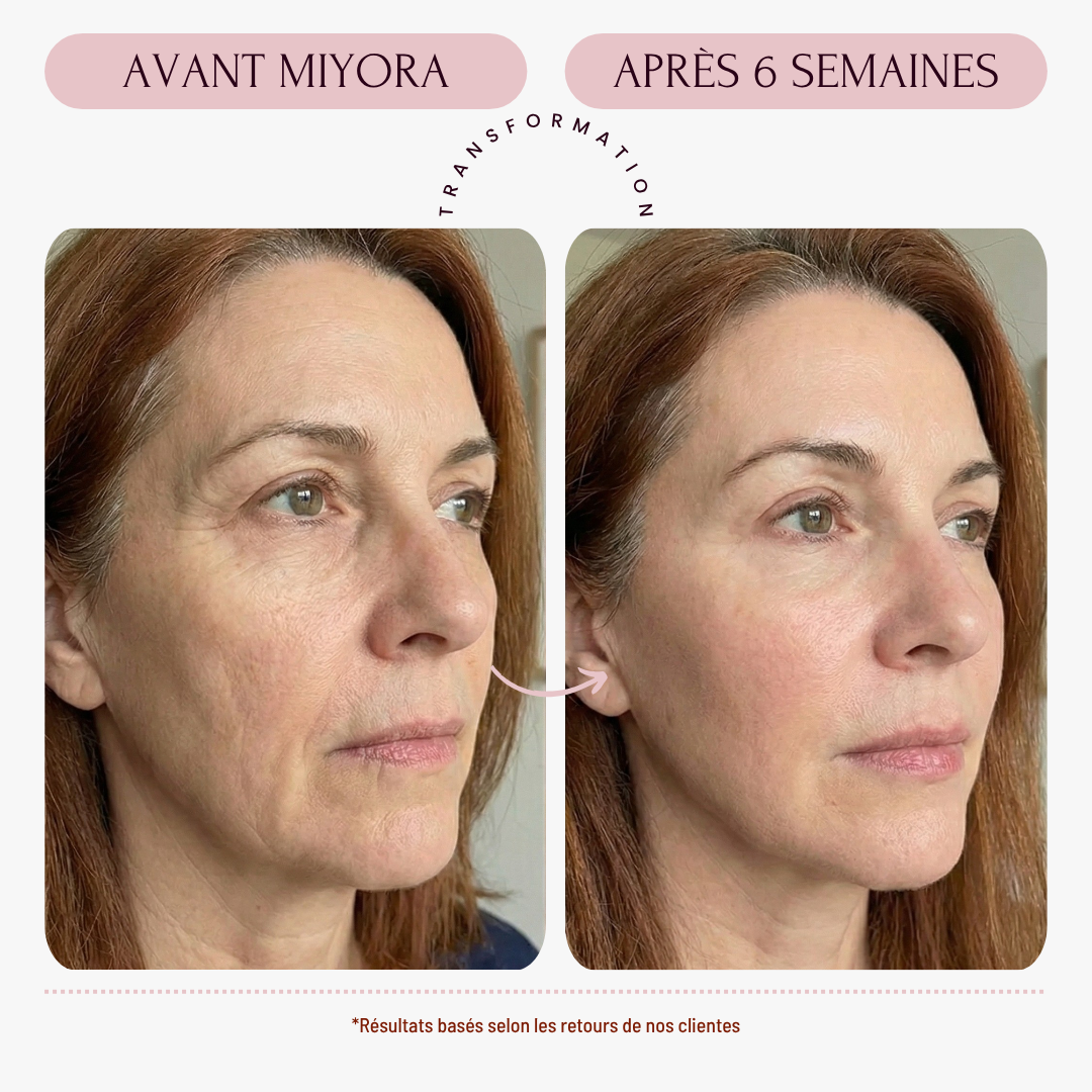 Miyora 24K Micro-Infusion Ritual