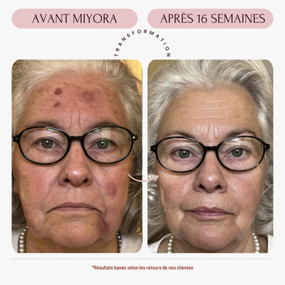 Miyora 24K Micro-Infusion Ritual