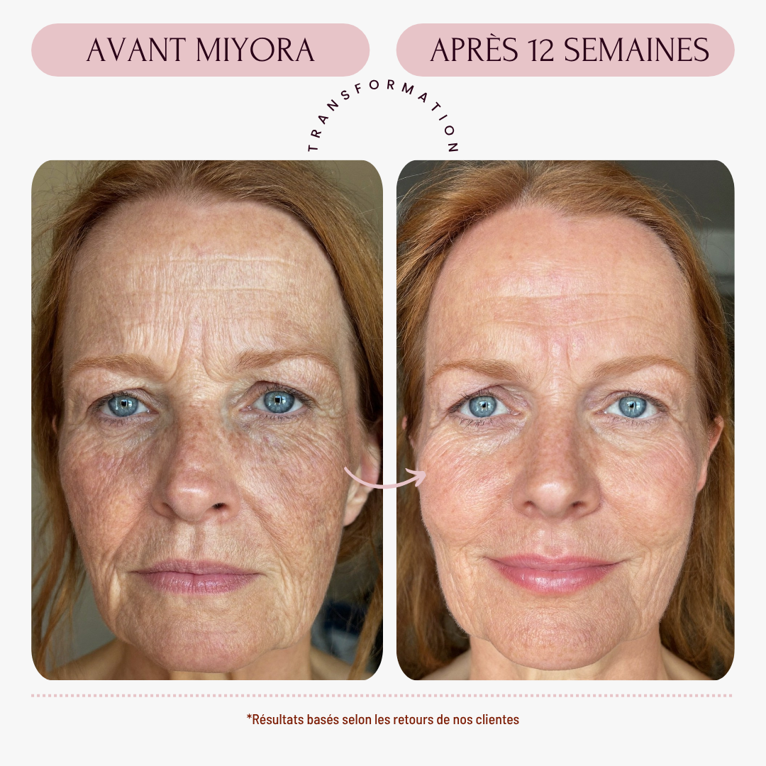 Miyora 24K Micro-Infusion Ritual