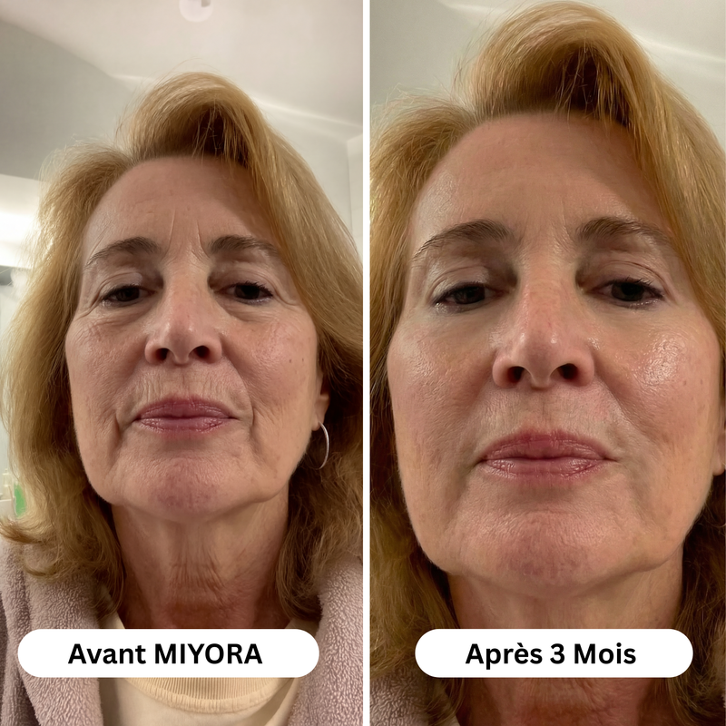 Isabelle M., 52 ans – Lyon