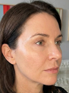 Sophie L., 47 ans – Montréal