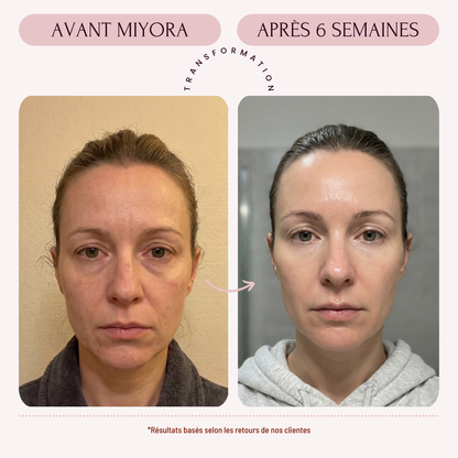 Miyora 24K Micro-Infusion Ritual Abonnement