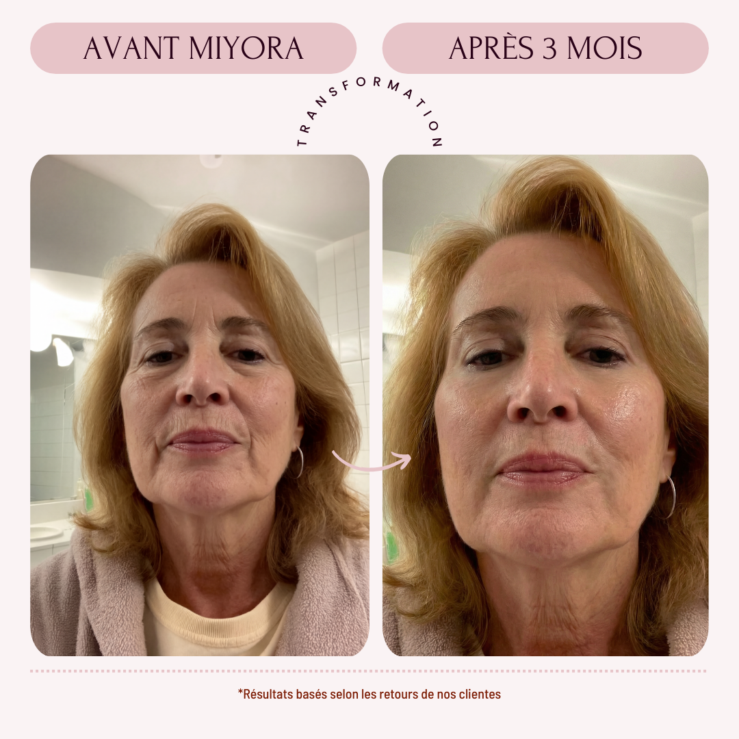 Miyora 24K Micro-Infusion Ritual