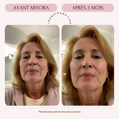 Miyora 24K Micro-Infusion Ritual