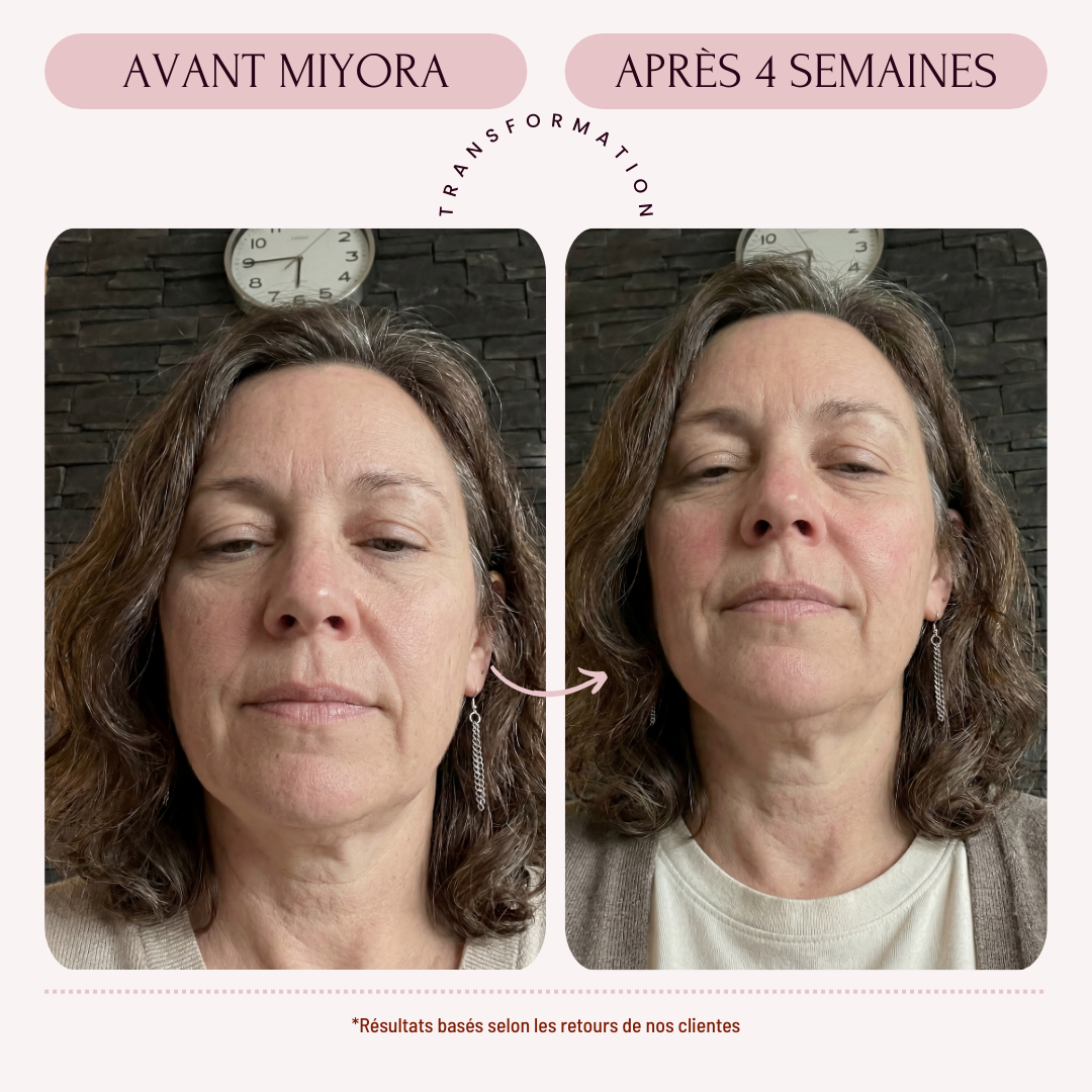 Miyora 24K Micro-Infusion Ritual